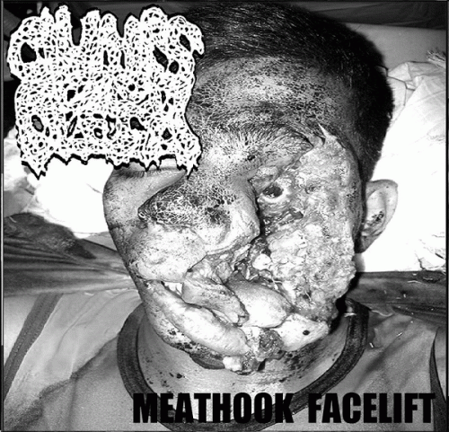 Clumps Of Flesh : Meathook Facelift